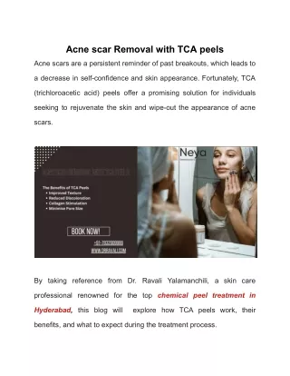 Acne scar Removal with TCA peels