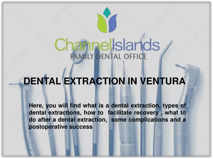 dental extraction in ventura
