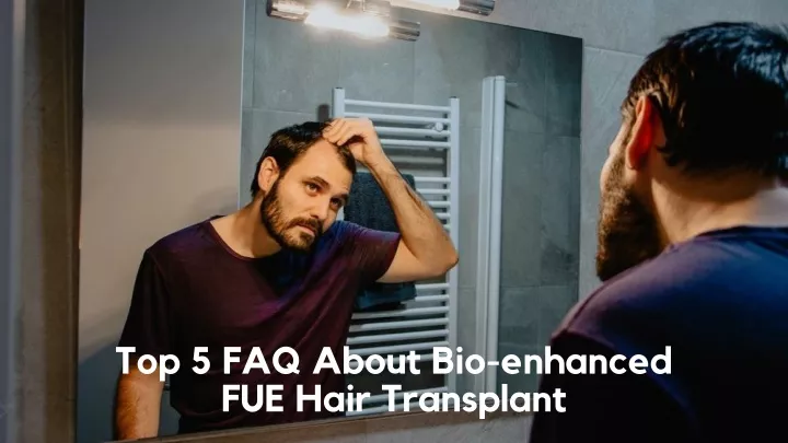 top 5 faq about bio enhanced fue hair transplant