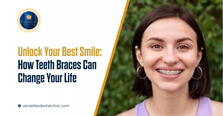 unlock your best smile how teeth braces