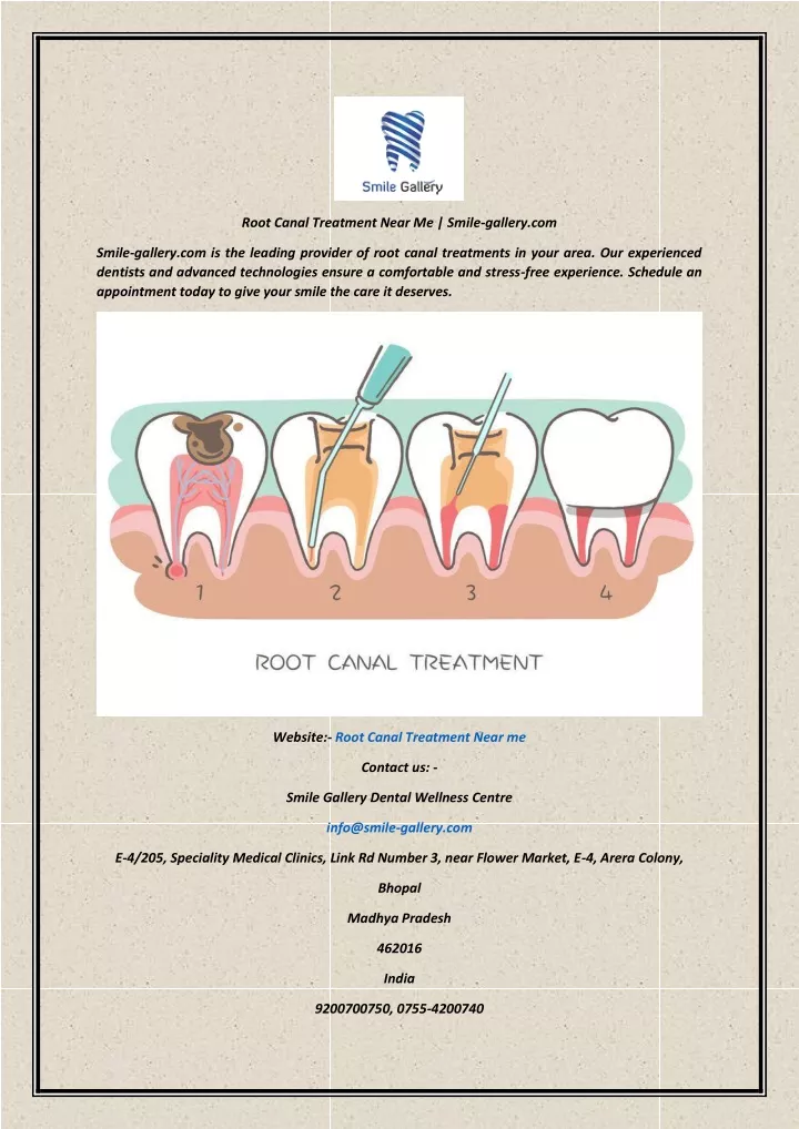 root canal treatment near me smile gallery com