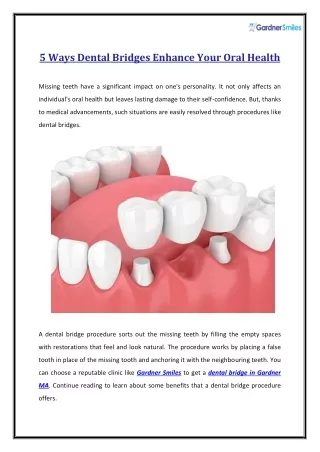 5 Ways to Enhance Your Oral Health with Dental Bridges
