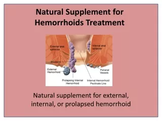 Cure Piles Anal Fissure Hemorrhoids Completely