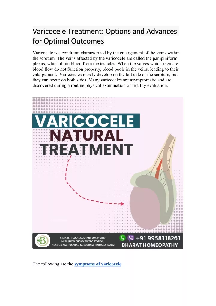 varicocele varicocele treatment treatment options