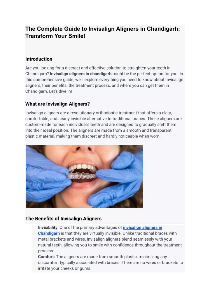 the complete guide to invisalign aligners
