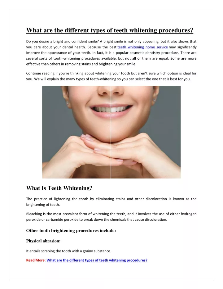 what are the different types of teeth whitening