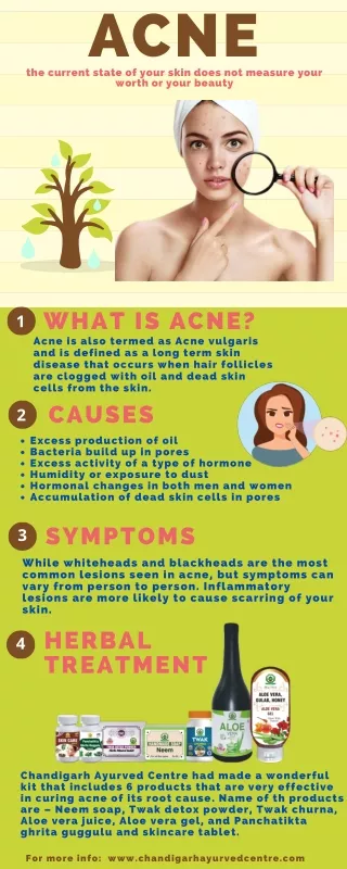 Acne and its Ayurvedic Treatment