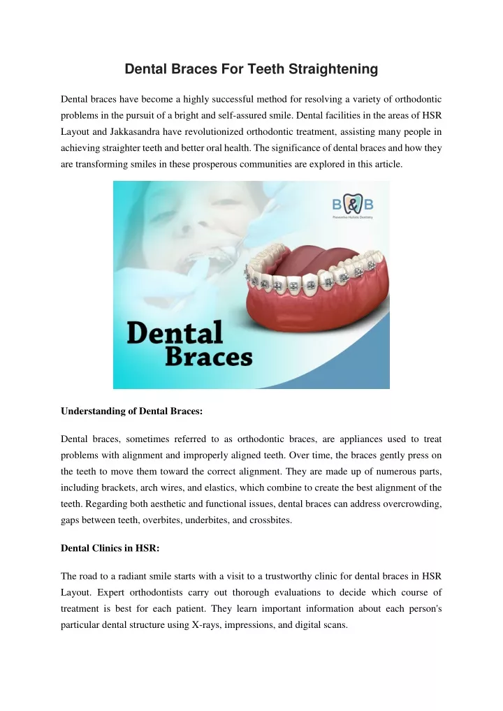 dental braces for teeth straightening