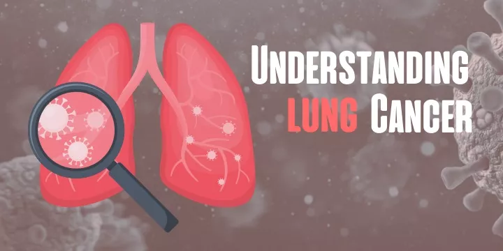 understanding cancer lung