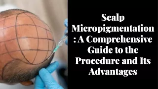 Scalp Micropigmentation: Understand the Procedure and Why it is Beneficial
