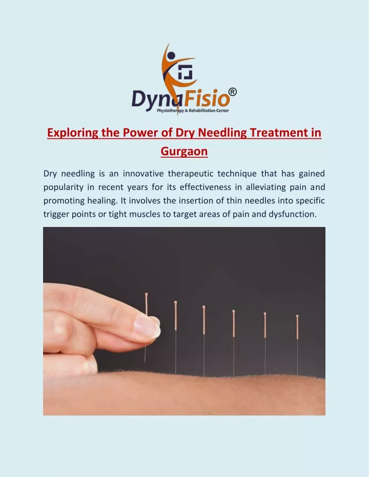 exploring the power of dry needling treatment