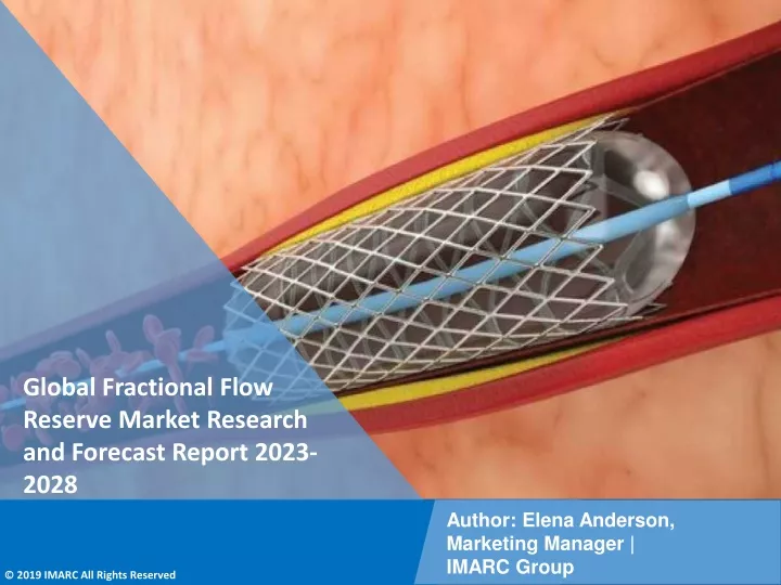 global fractional flow reserve market research