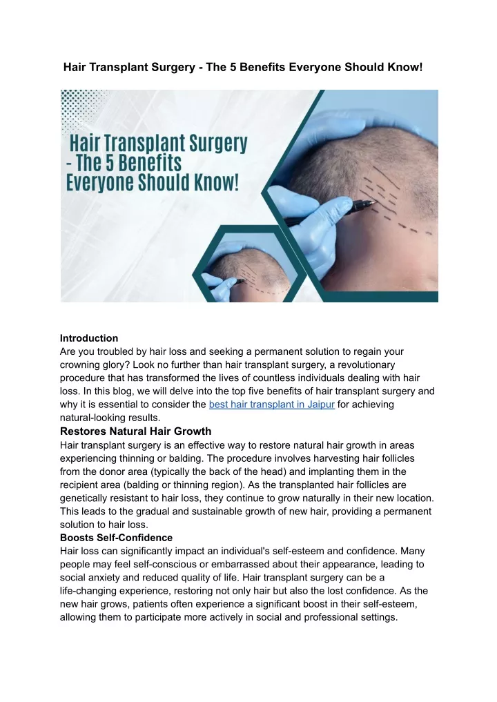 hair transplant surgery the 5 benefits everyone