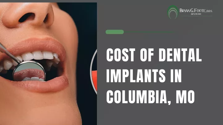 cost of dental implants in columbia mo