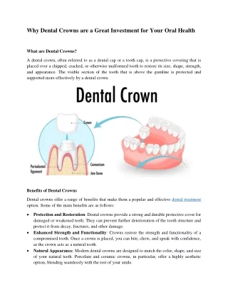 Why Dental Crowns are a Great Investment for Your Oral Health
