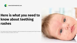 Here is what you need to know about teething rashes