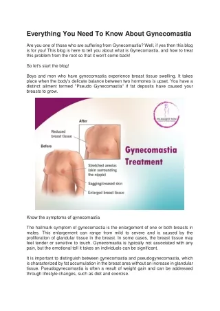 Everything You Need To Know About Gynecomastia