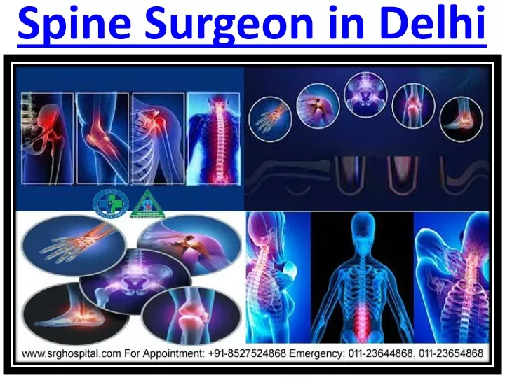 spine surgeon in delhi