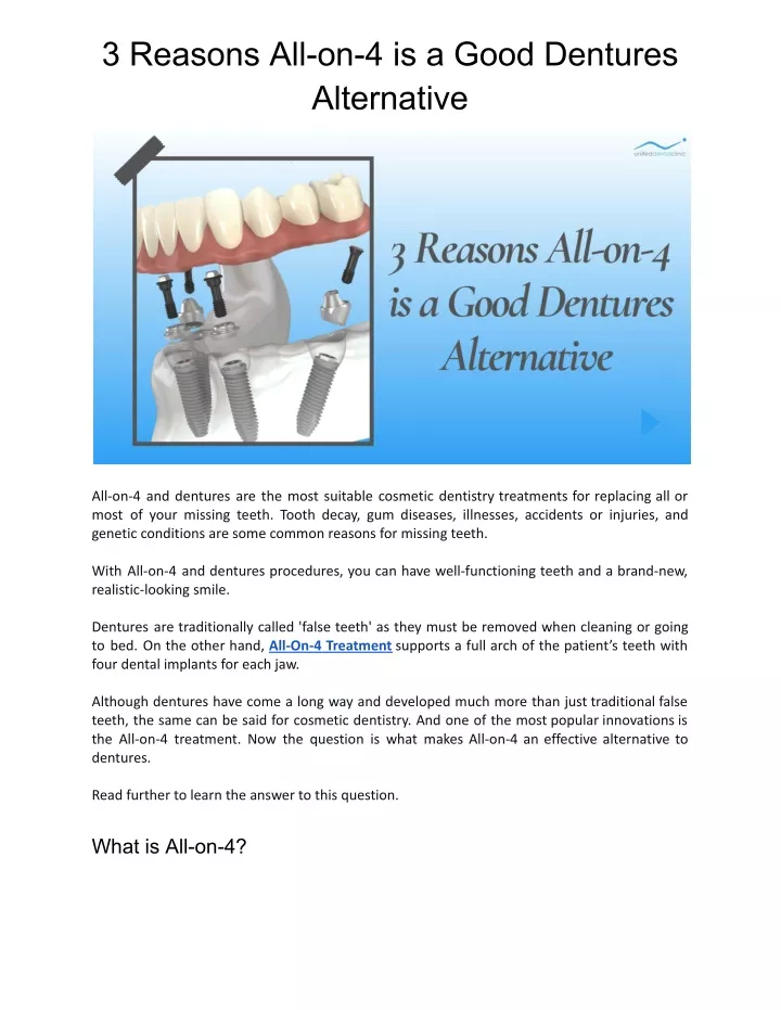 3 reasons all on 4 is a good dentures alternative