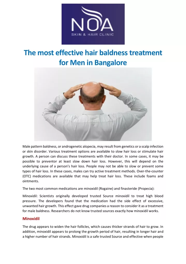 the most effective hair baldness treatment