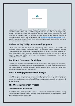 Find Expert Micropigmentation Services for Vitiligo Near You