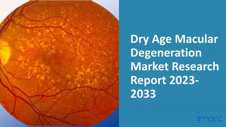 dry age macular degeneration market research report 2023 2033