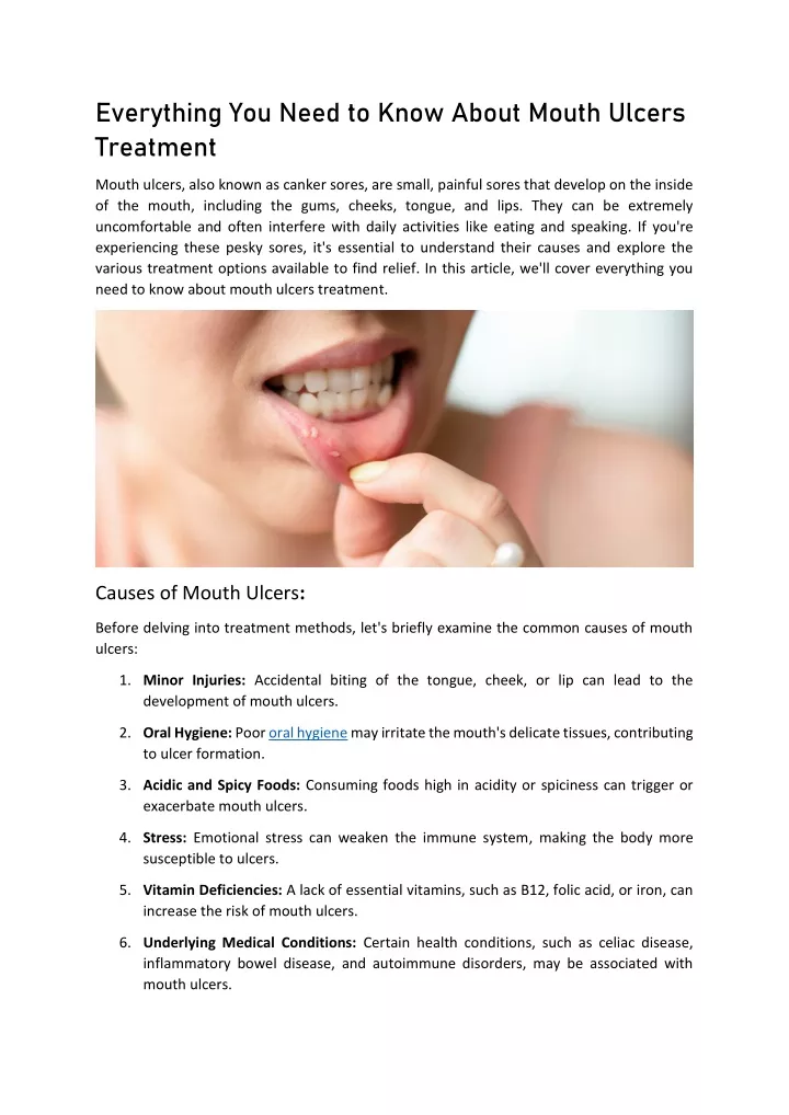 everything you need to know about mouth ulcers