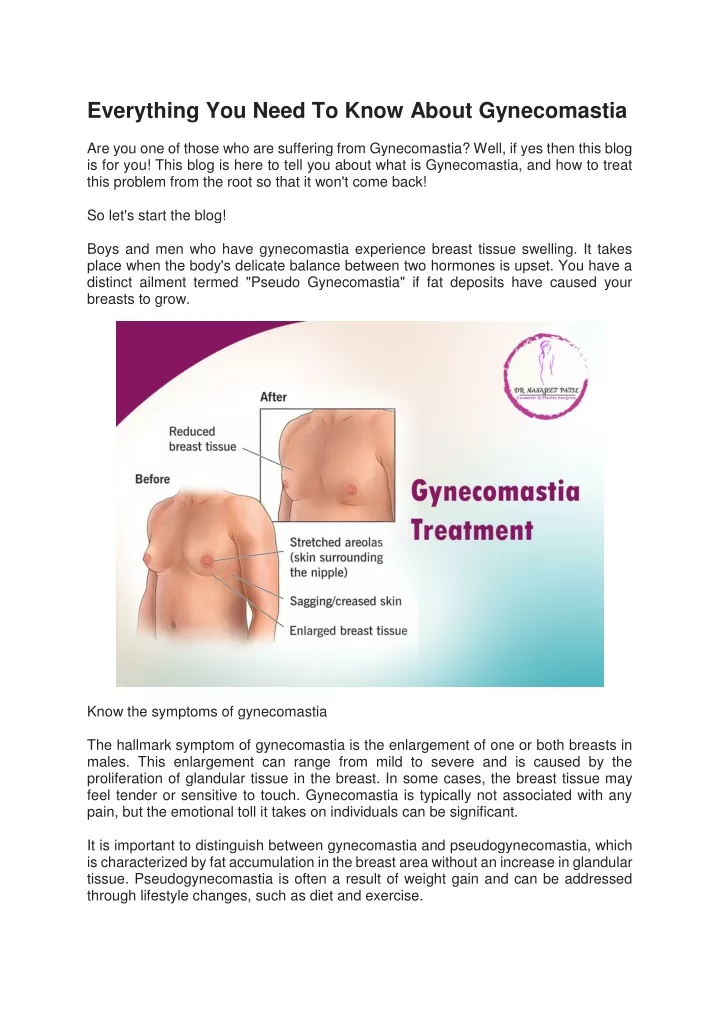 everything you need to know about gynecomastia