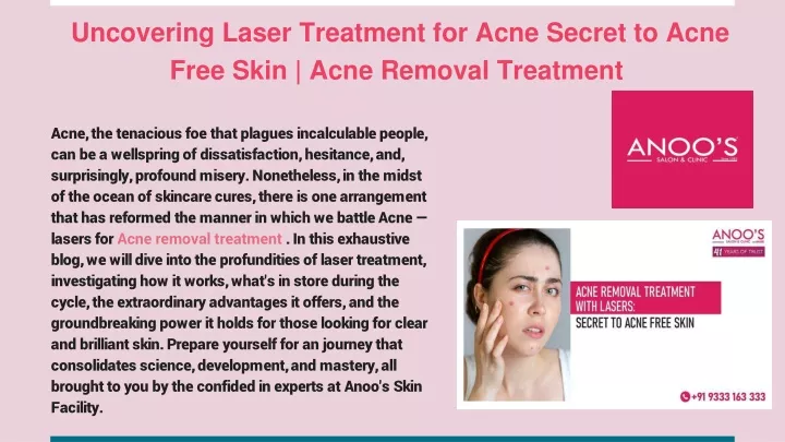 uncovering laser treatment for acne secret to acne free skin acne removal treatment