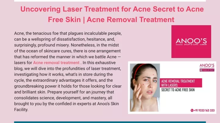 uncovering laser treatment for acne secret
