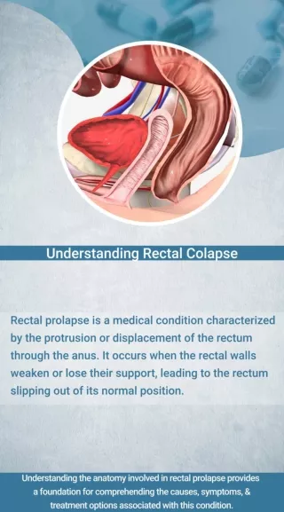 Rectal Prolapse: Symptoms, Causes, diagnosing & Treatment