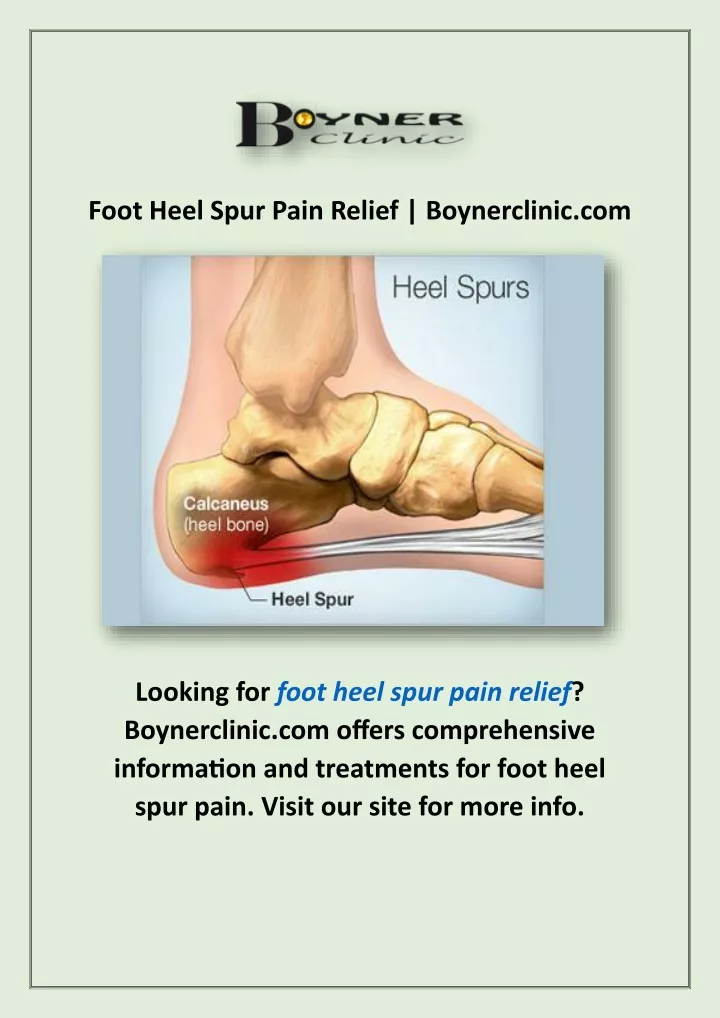 foot heel spur pain relief boynerclinic com