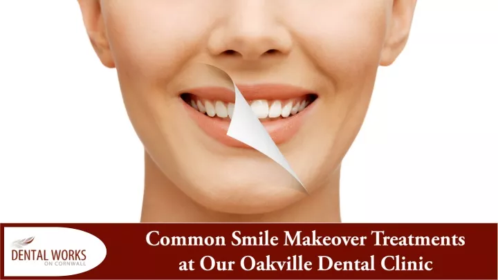 common smile makeover treatments at our oakville