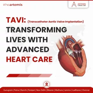 Revolutionizing Heart Care: Transcatheter Aortic Valve Implantation (TAVI)