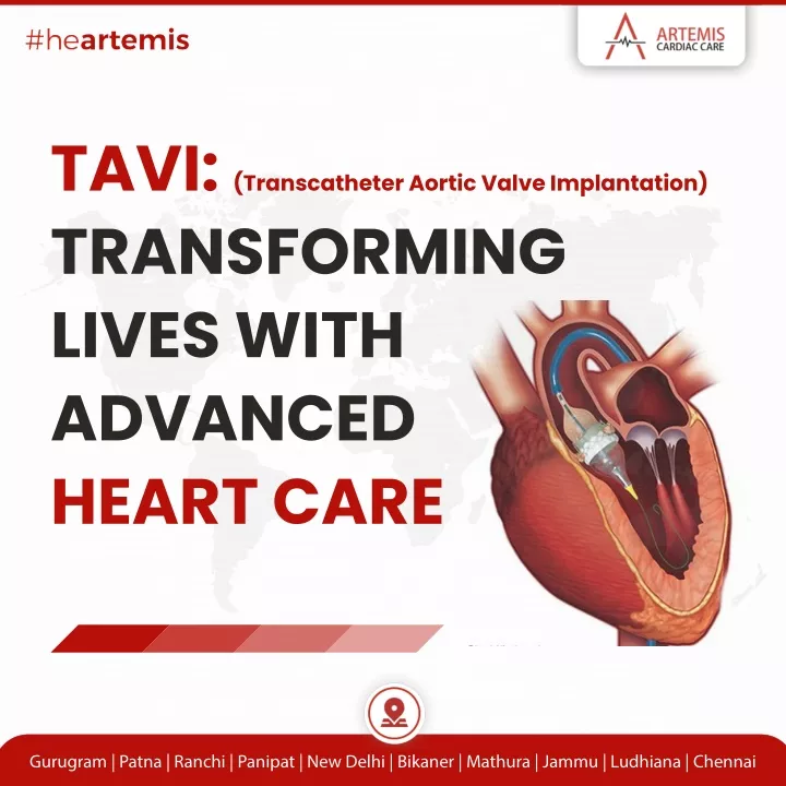 tavi transcatheter aortic valve implantation