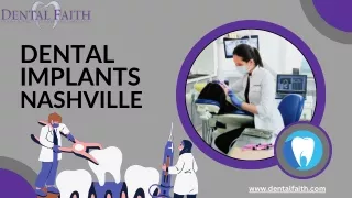 Dental Implant Nashville |  Dental Faith
