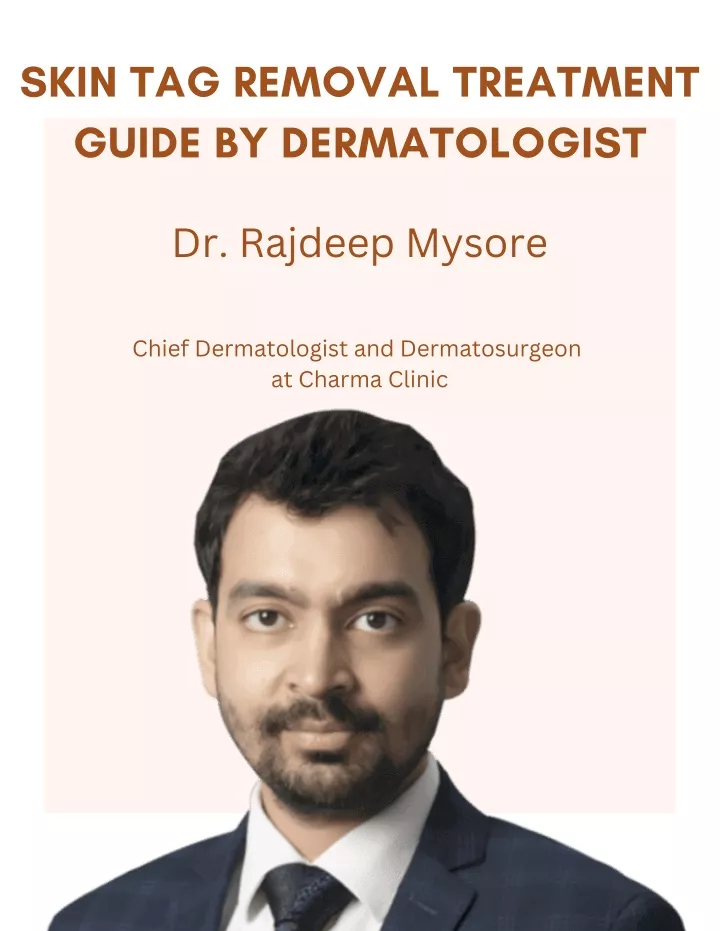 skin tag removal treatment guide by dermatologist