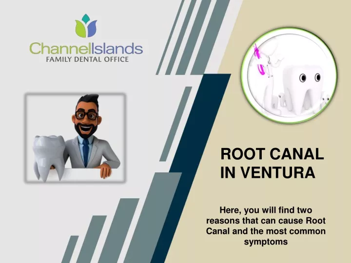 root canal in ventura