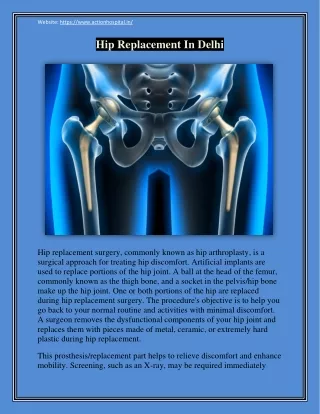 Best Hip Replacement Surgery in Delhi NCR At SBAMI