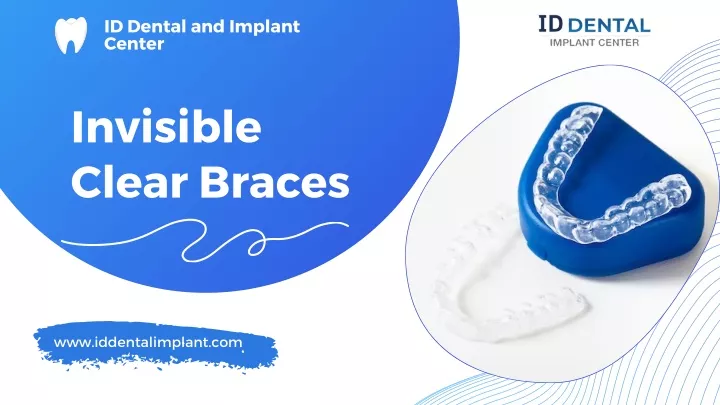 id dental and implant center