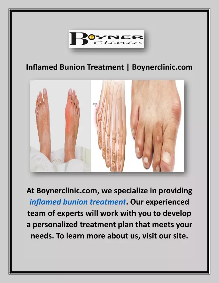 inflamed bunion treatment boynerclinic com