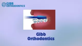 Gibb Orthodontics Embrace Your Perfect Smile with Invisalign
