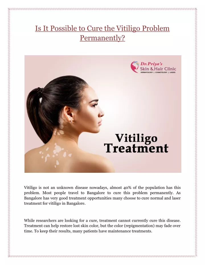 is it possible to cure the vitiligo problem