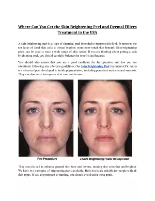 Where Can You Get the Skin Brightening Peel and Dermal Fillers Treatment in the USA