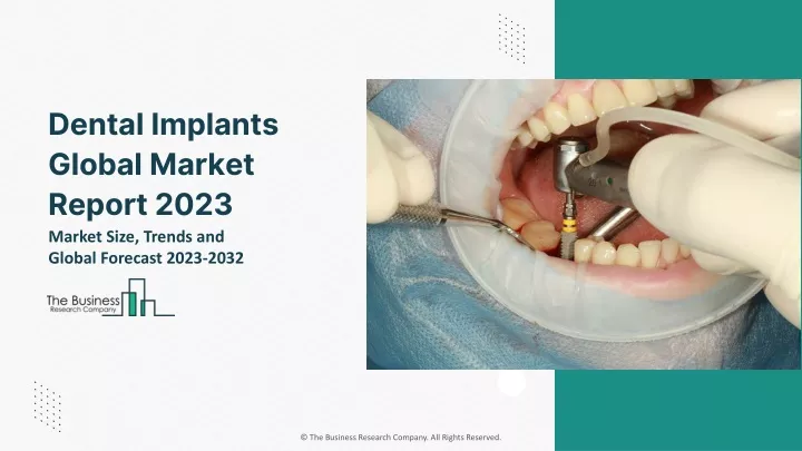 dental implants global market report 2023