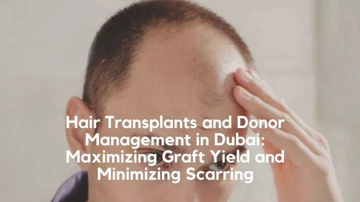 hair transplants and donor management in dubai