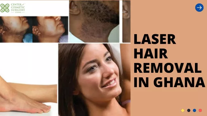 laser hair removal in ghana