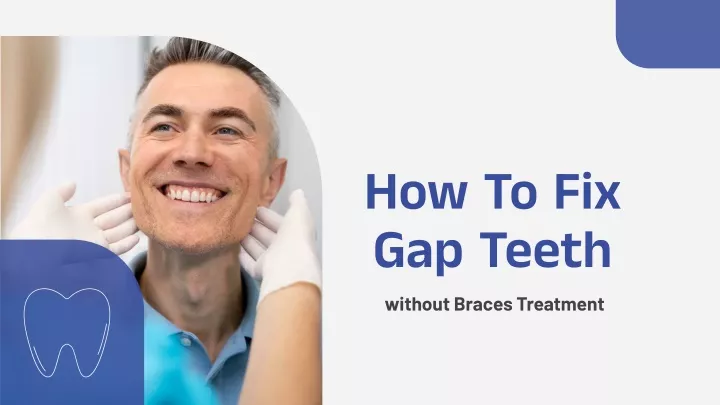 how to fix gap teeth without braces treatment