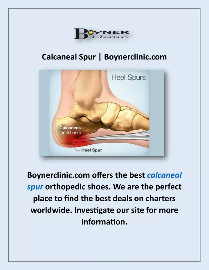 calcaneal spur boynerclinic com