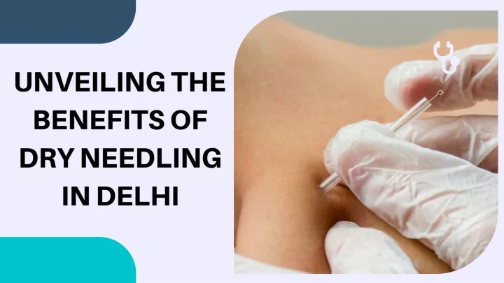 unveiling the benefits of dry needling in delhi